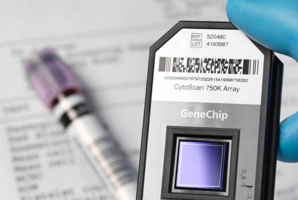 Sequencing Equipment
